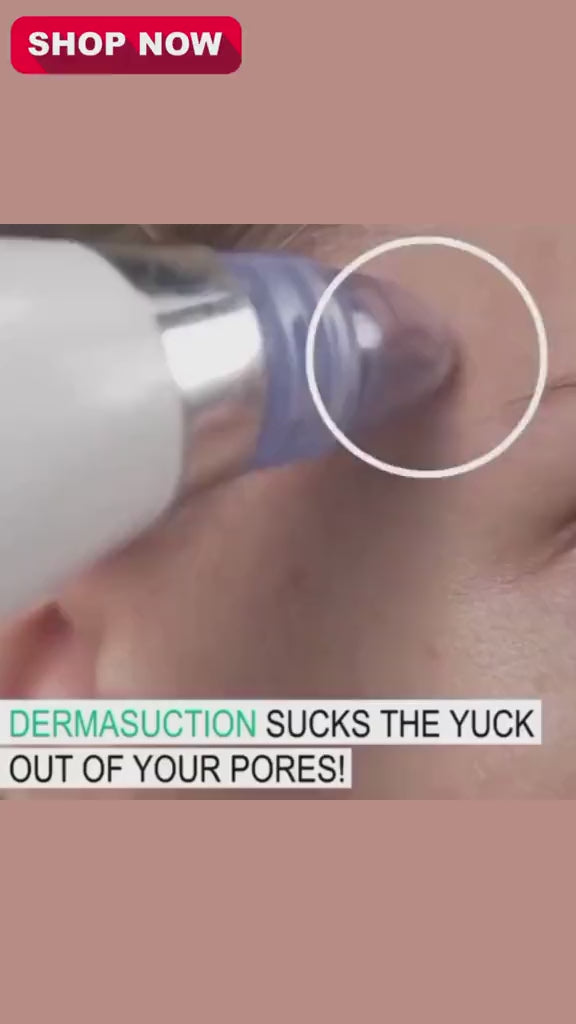 Electric Blackhead Remover Vacuum for Face